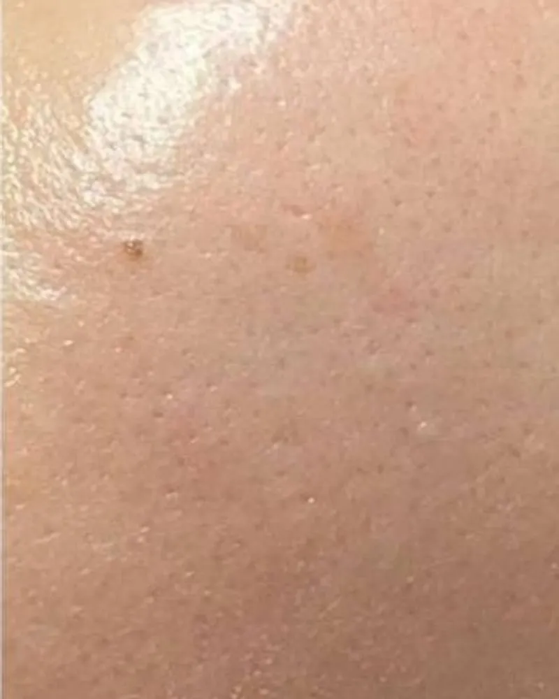After: Texture and pores