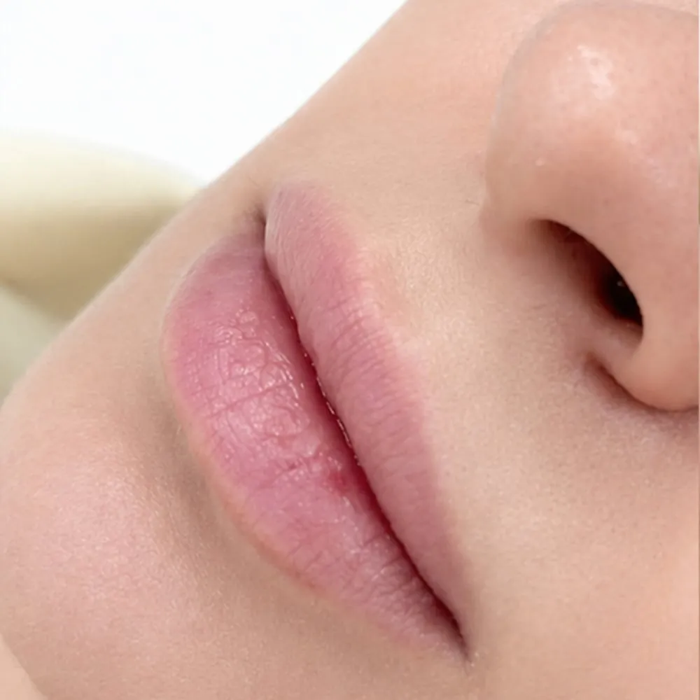 Before: Contour definition