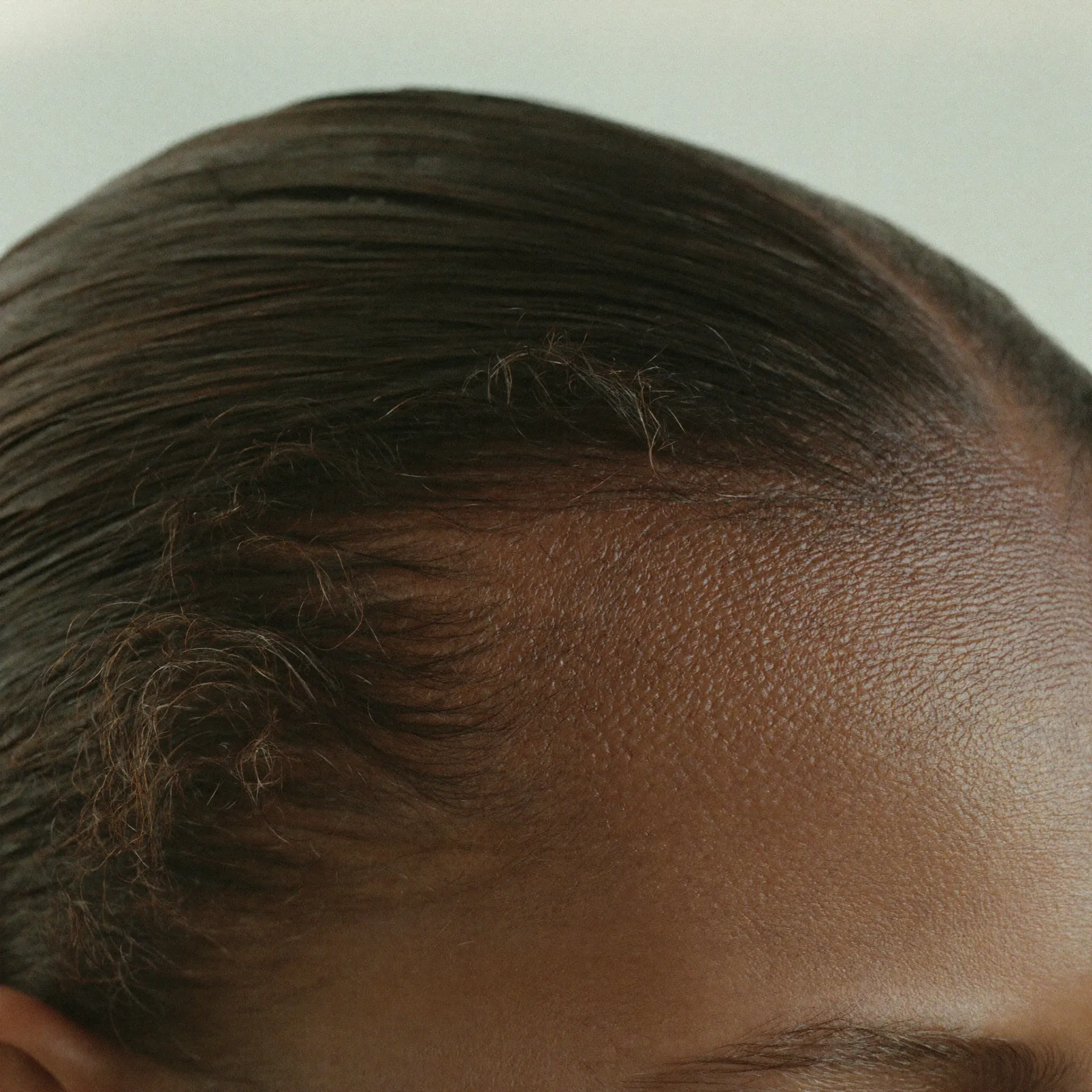 Hair loss: where to start and what actually helps