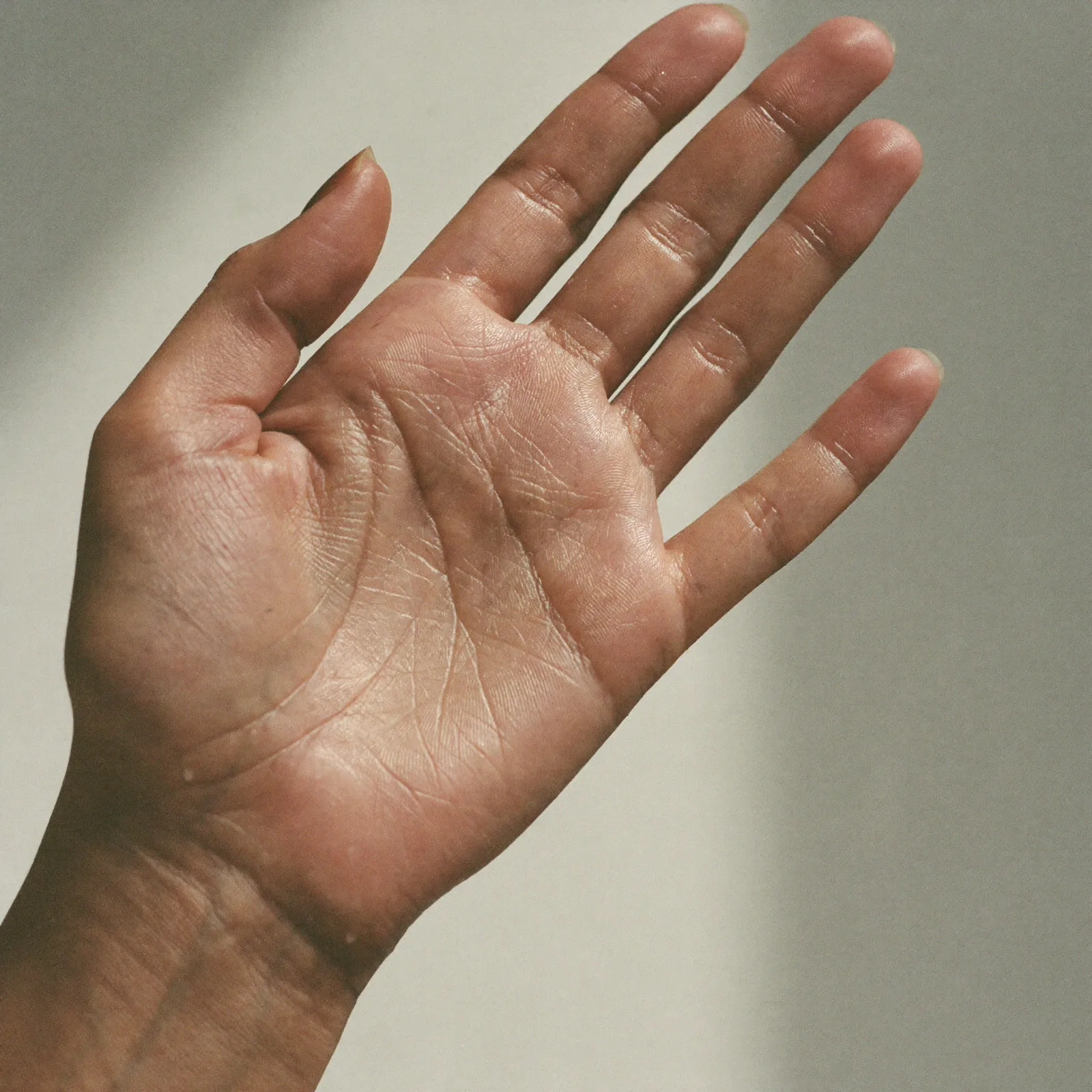 A dry, calm palm—one of the areas the protocol works with