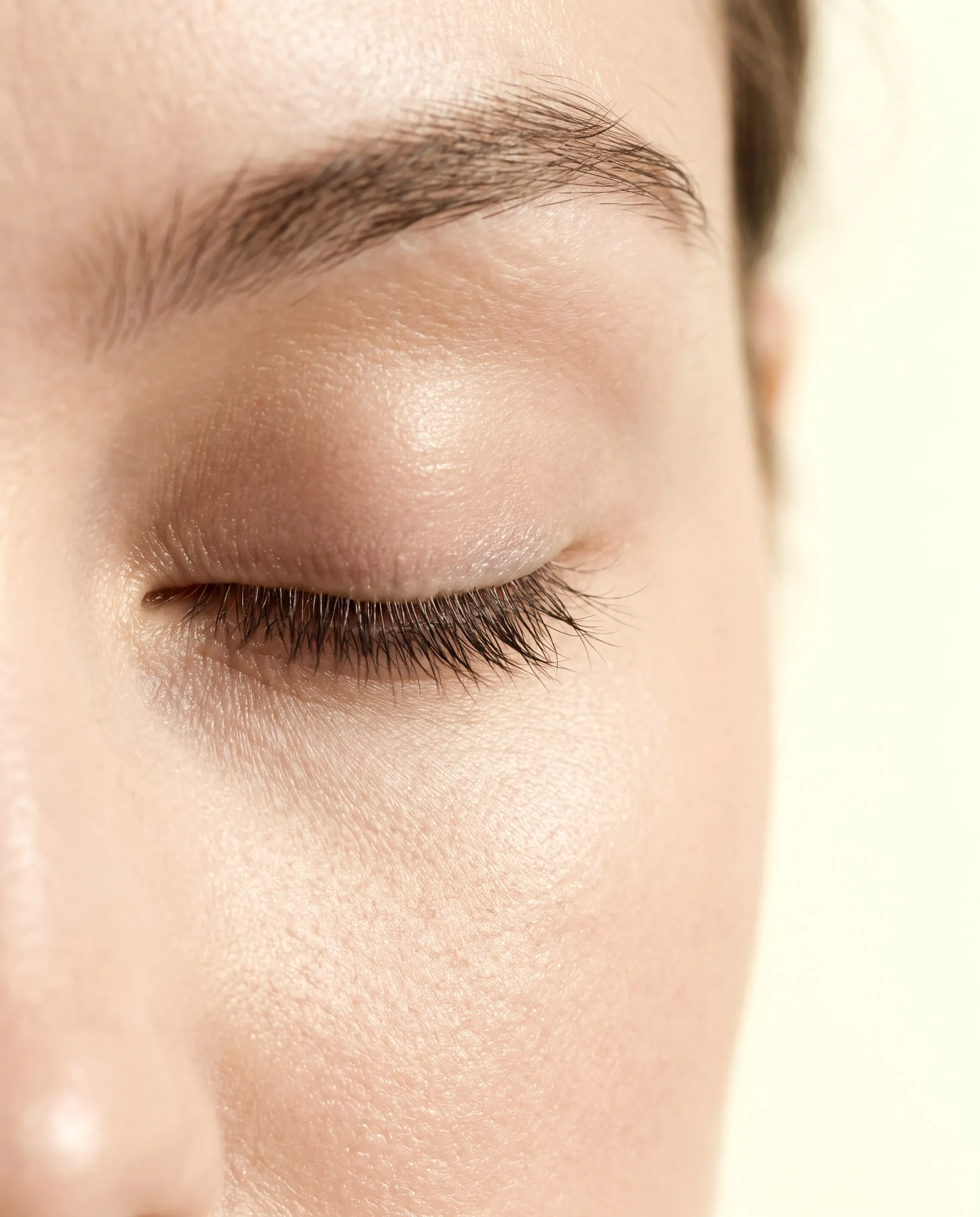Exosome therapy—skin at rest after the treatment